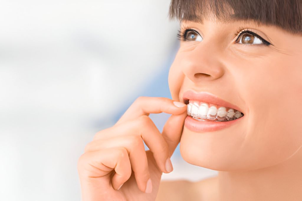 invisalign near you in ottawa